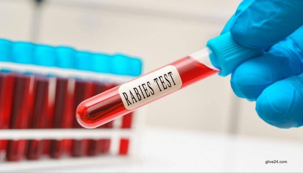 New Zealand reveals first-ever rabies death 5 New Zealand reveals first-ever rabies death