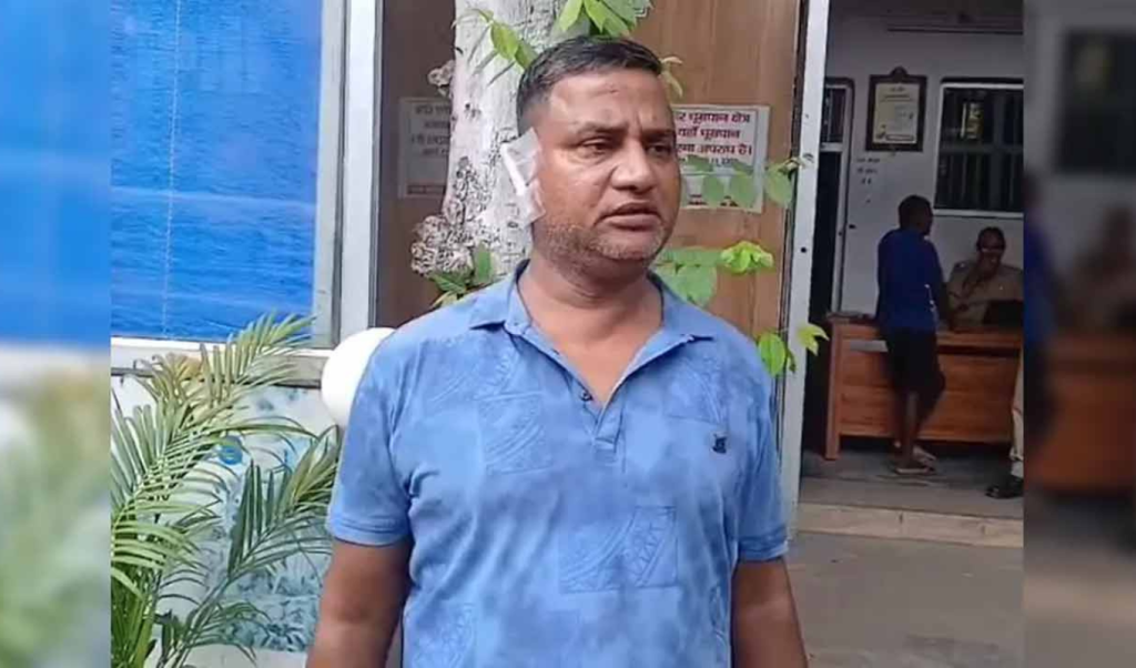 ভারতের উত্তর প্রদেশে দাম্পত্য কলহ: স্বামীর কান কামড়ে ছিঁড়ে নিলেন স্ত্রী