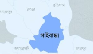 গাইবান্ধায় স্ত্রীর মুখে গরম রডের ছ্যাঁকা গোড়ালি কেটে দিল স্বামী গাইবান্ধায় স্ত্রীর মুখে গরম রডের ছ্যাঁকা, গোড়ালি কেটে দিল স্বামী