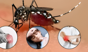 Chikungunya and Dengue Claim Lives of 21 Children in Crisis Stricken Cuba Cuba Reports Deadly Surge in Chikungunya and Dengue Amid Deepening Crisis