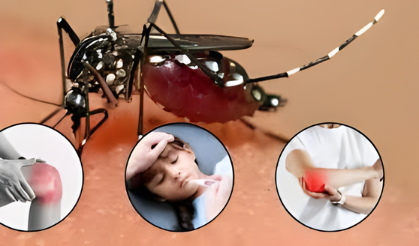 Chikungunya and Dengue Claim Lives of 21 Children in Crisis Stricken Cuba Cuba Reports Deadly Surge in Chikungunya and Dengue Amid Deepening Crisis