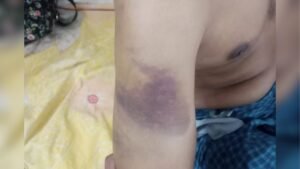 Brutal Abuse Allegations at Gaibandha Rehabilitation Centre Brutal Abuse Allegations at Gaibandha Rehabilitation Centre
