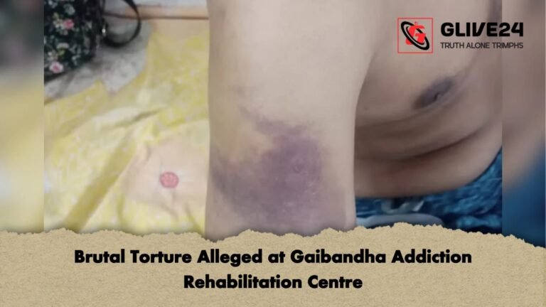 Brutal Torture Alleged at Gaibandha Addiction Rehabilitation Centre Brutal Torture Alleged at Gaibandha Addiction Rehabilitation Centre
