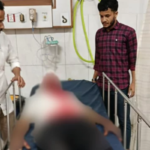 Railway Worker Injured in Stone Attack Near Chakaria Railway Worker Injured in Stone Attack Near Chakaria