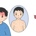 Chittagong to Vaccinate 300000 Children Against Measles Rubella Three Lakh Children to Be Vaccinated