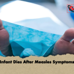 Infant Dies After Measles Symptoms Infant Dies After Measles Symptoms