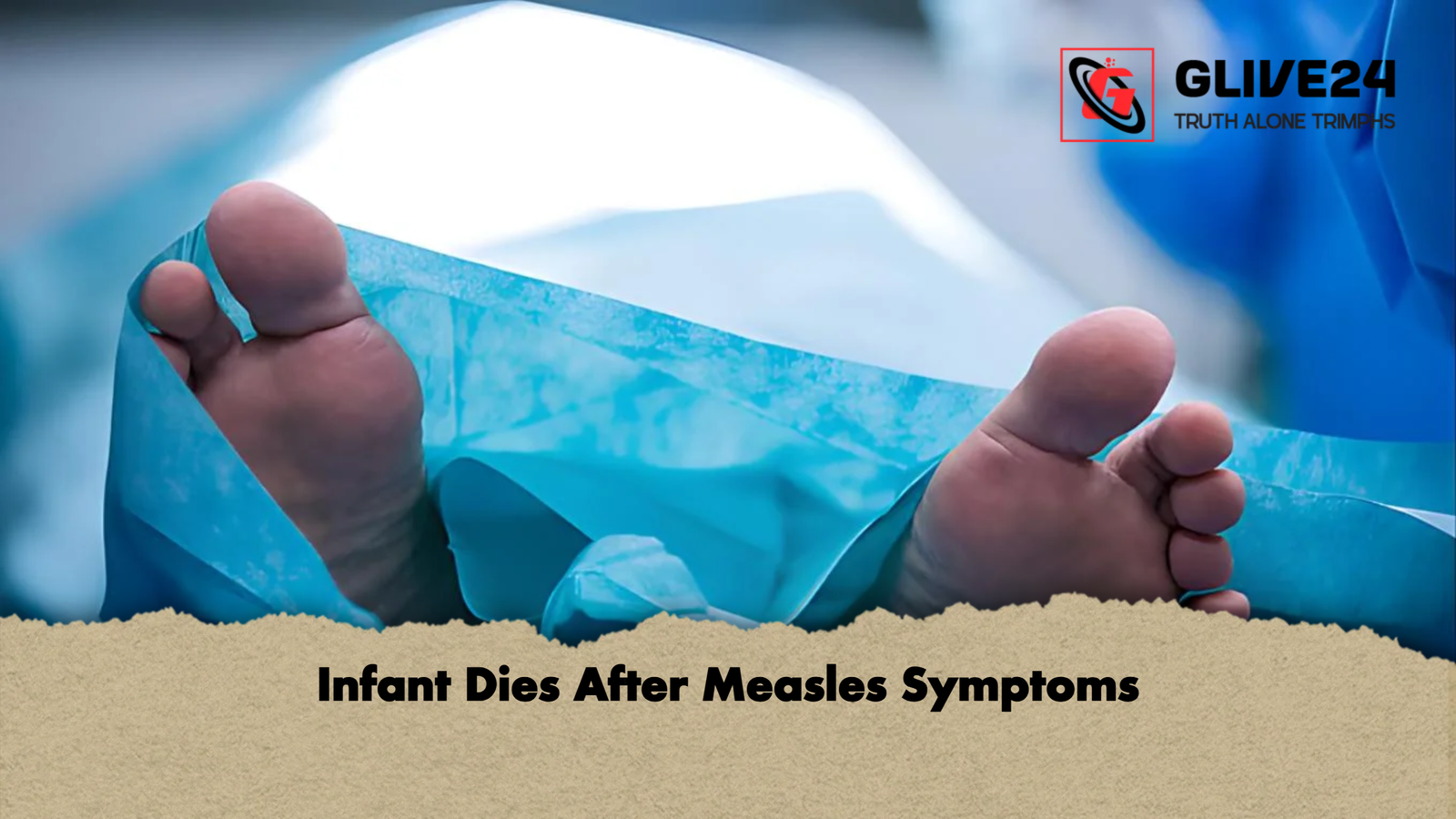 Infant Dies After Measles Symptoms Infant Dies After Measles Symptoms