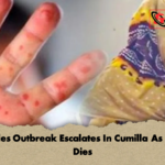 Measles Outbreak Escalates In Cumilla As Infant Dies 2 Measles Outbreak Escalates In Cumilla As Infant Dies