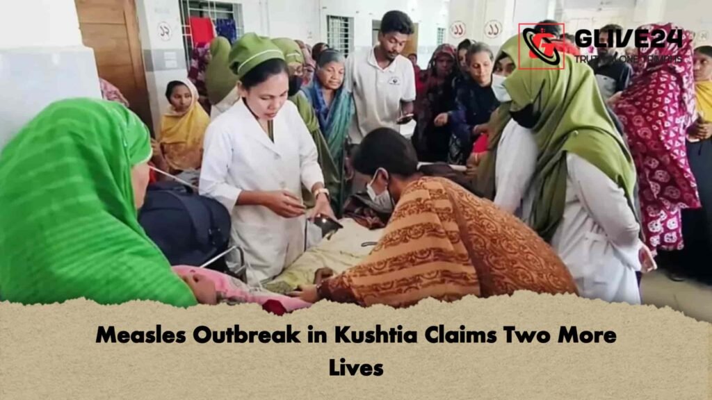 Measles Outbreak in Kushtia Claims Two More Lives 2 Measles Outbreak in Kushtia Claims Two More Lives