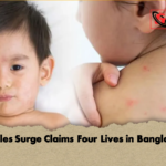 Measles Surge Claims Four Lives in Bangladesh Measles Surge Claims Four Lives in Bangladesh