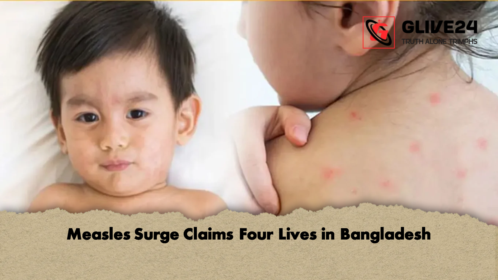Measles Surge Claims Four Lives in Bangladesh Measles Surge Claims Four Lives in Bangladesh