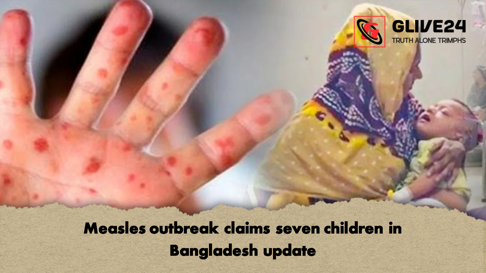 Measles outbreak claims seven children in Bangladesh update 1 Measles outbreak claims seven children in Bangladesh update Measles outbreak claims seven children in Bangladesh update