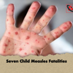 Seven Child Measles Fatalities Seven Child Measles Fatalities