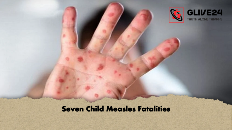 Seven Child Measles Fatalities Seven Child Measles Fatalities