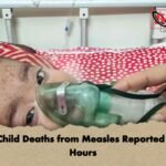 Three Child Deaths from Measles Reported Within Hours
