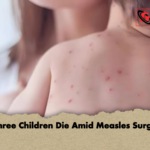 Three Children Die Amid Measles Surge Three Children Die Amid Measles Surge