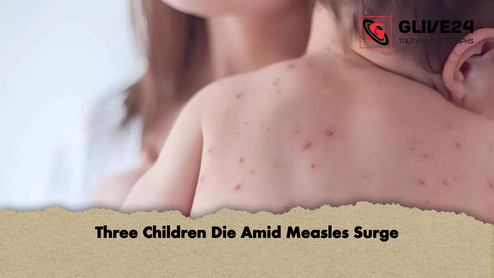 Three Children Die Amid Measles Surge Three Children Die Amid Measles Surge