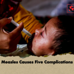 news thumbnail 1777361135495 Measles Causes Five Complications