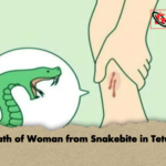 Death of Woman from Snakebite in Tetulia Death of Woman from Snakebite in Tetulia