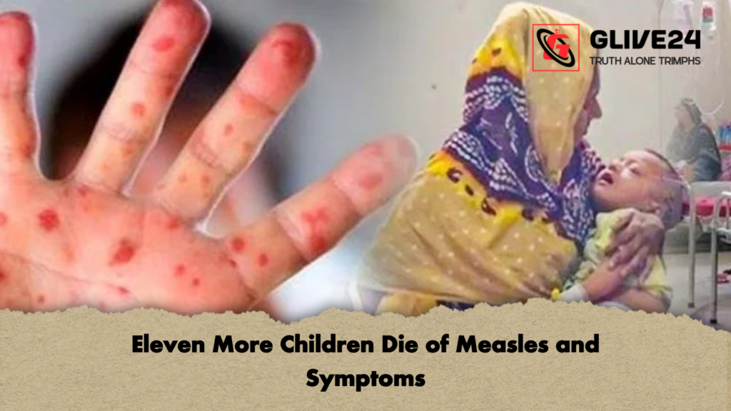 Eleven More Children Die of Measles and Symptoms Eleven More Children Die of Measles and Symptoms