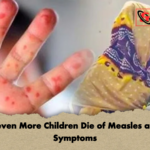 Eleven More Children Die of Measles and Symptoms Eleven More Children Die of Measles and Symptoms