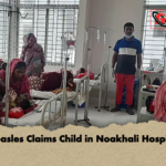 Measles Claims Child in Noakhali Hospital Measles Claims Child in Noakhali Hospital