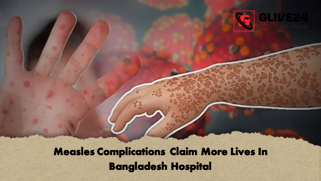 Measles Complications Claim More Lives In Bangladesh Hospital 1 Measles Complications Claim More Lives In Bangladesh Hospital 2 Measles Complications Claim More Lives In Bangladesh Hospital