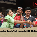 Measles Death Toll Exceeds 300 Children Measles Death Toll Exceeds 300 Children