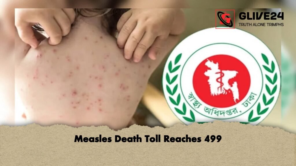 Measles Death Toll Reaches 499 2 Measles Death Toll Reaches 499