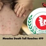 Measles Death Toll Reaches 499 2 Measles Death Toll Reaches 499