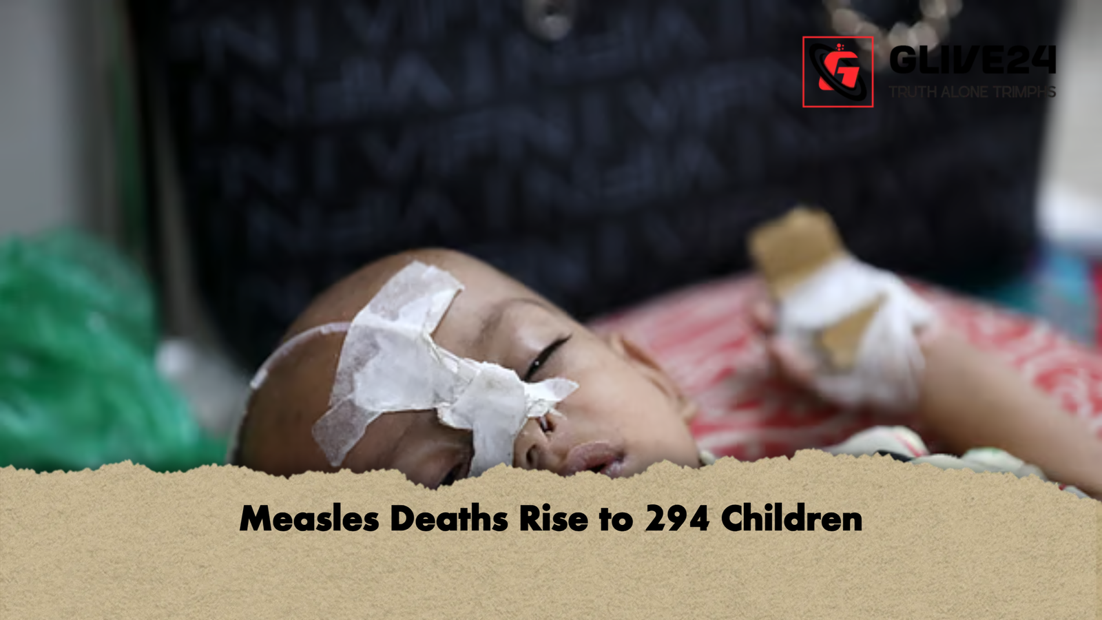 Measles Deaths Rise to 294 Children Measles Deaths Rise to 294 Children