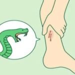 তেঁতুলিয়ায় সাপের কামড়ে নারীর মৃত্যু Snakebite Death in Panchagarh