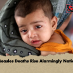 Child Measles Deaths Rise Alarmingly Nationwide Child Measles Deaths Rise Alarmingly Nationwide