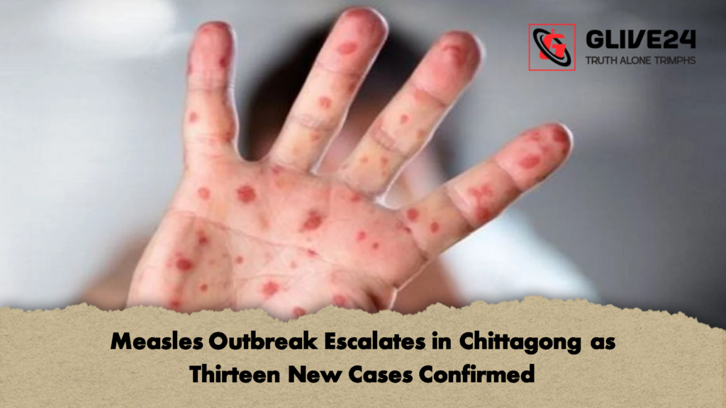 Measles Outbreak Escalates in Chittagong as Thirteen New Cases Confirmed 2 Measles Outbreak Escalates in Chittagong as Thirteen New Cases Confirmed