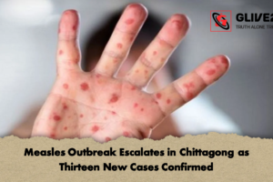 Measles Outbreak Escalates in Chittagong as Thirteen New Cases Confirmed