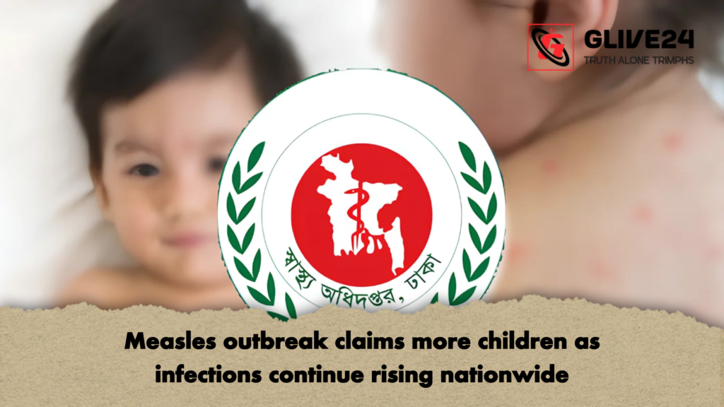 Measles outbreak claims more children as infections continue rising nationwide 2 Measles outbreak claims more children as infections continue rising nationwide