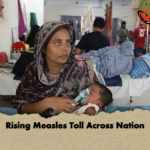 Rising Measles Toll Across Nation Rising Measles Toll Across Nation
