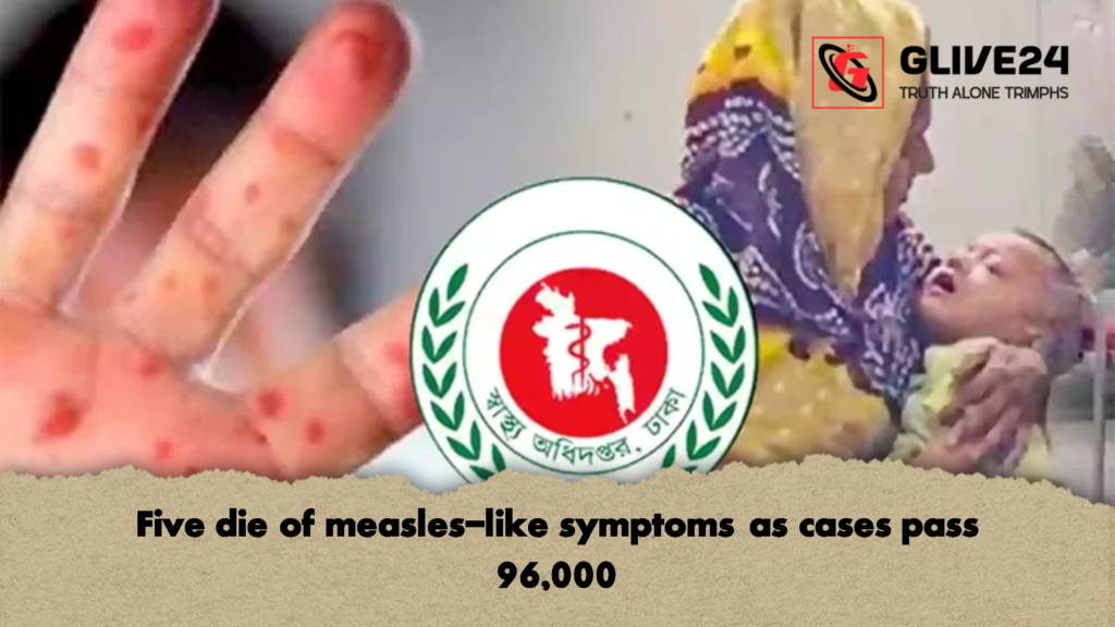 Five die of measles like symptoms as cases pass 96000 2 Five die of measles-like symptoms as cases pass 96,000