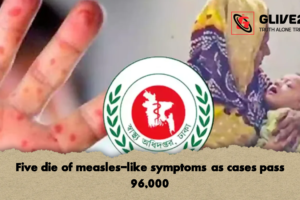 Five die of measles-like symptoms as cases pass 96,000