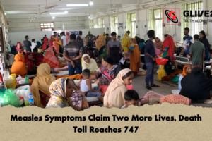 Measles Symptoms Claim Two More Lives, Death Toll Reaches 747