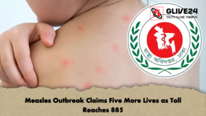 Measles Outbreak Claims Five More Lives as Toll Reaches 885 2 Measles Outbreak Claims Five More Lives as Toll Reaches 885