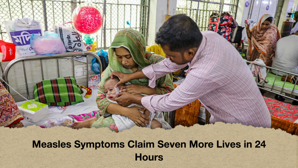 Measles Symptoms Claim Seven More Lives in 24 Hours Measles Symptoms Claim Seven More Lives in 24 Hours