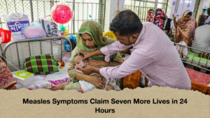 Measles Symptoms Claim Seven More Lives in 24 Hours Measles Symptoms Claim Seven More Lives in 24 Hours