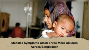 Measles Symptoms Claim Three More Children Across Bangladesh