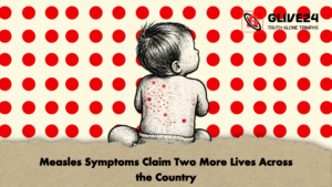 Measles Symptoms Claim Two More Lives Across the Country 2 Measles Symptoms Claim Two More Lives Across the Country