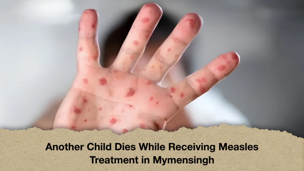 Another Child Dies While Receiving Measles Treatment in Mymensingh