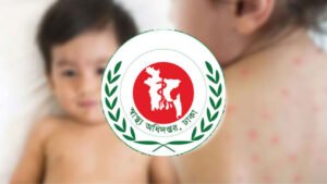 Childhood Deaths Rise as Measles Outbreak Escalates Across Bangladesh Childhood Deaths Rise as Measles Outbreak Escalates Across Bangladesh