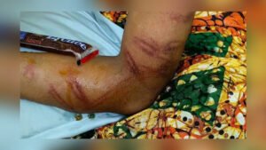 Madrasa Teacher Held Over Alleged Assault on Student