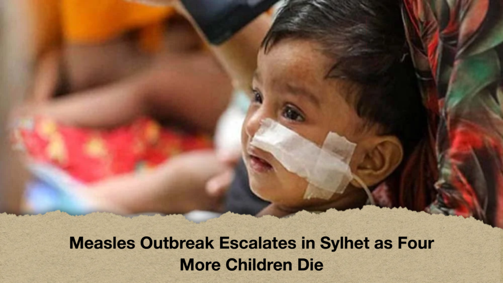 Measles Outbreak Escalates in Sylhet as Four More Children Die 2 Measles Outbreak Escalates in Sylhet as Four More Children Die