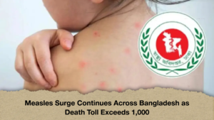 Measles Surge Continues Across Bangladesh as Death Toll Exceeds 1,000